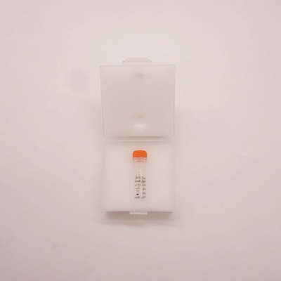 Fluoresensi In Situ Hybridization Reagen CBFB Dual Color Break Apart Probe