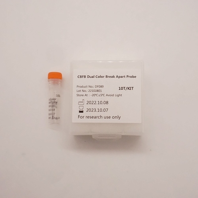 Fluoresensi In Situ Hybridization Reagen CBFB Dual Color Break Apart Probe